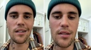‘Right side of my face is paralysed after virus attack’ says Justin Bieber